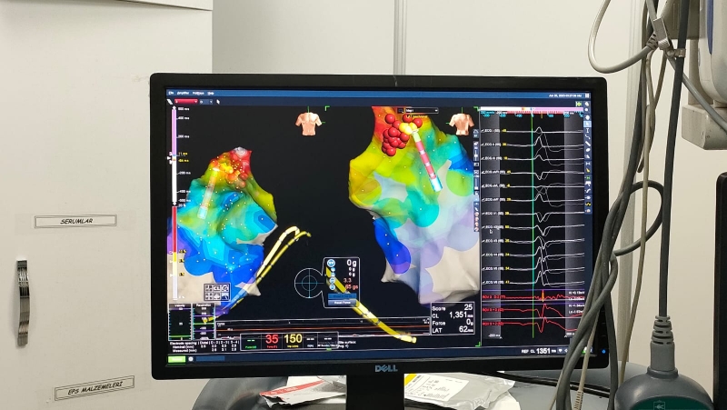 Şanlıurfa Harran Üniversitesi Tıp Fakültesi Hastanesi Kardiyoloji Anabilim Dalı Aritmi Merkezinde kalp çarpıntılarının tedavisi güncel teknolojiler kullanılarak yapılıyor